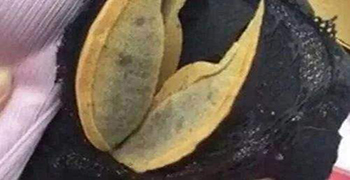 內(nèi)衣發(fā)霉怎么辦？霉博來(lái)士教你除霉措施！