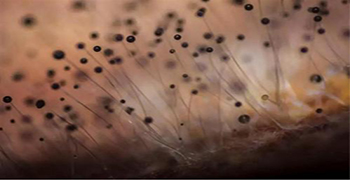 霉博士帶你正確認(rèn)識(shí)微生物！