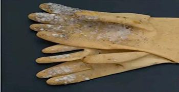 微生物災(zāi)害所涉及的領(lǐng)域有多少（三）？