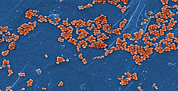 細(xì)菌毒素有哪些？
